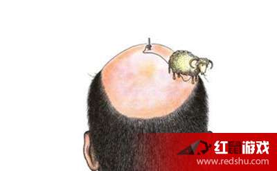 男人秃顶怎么办 治疗秃顶的方法有什么_红鼠手