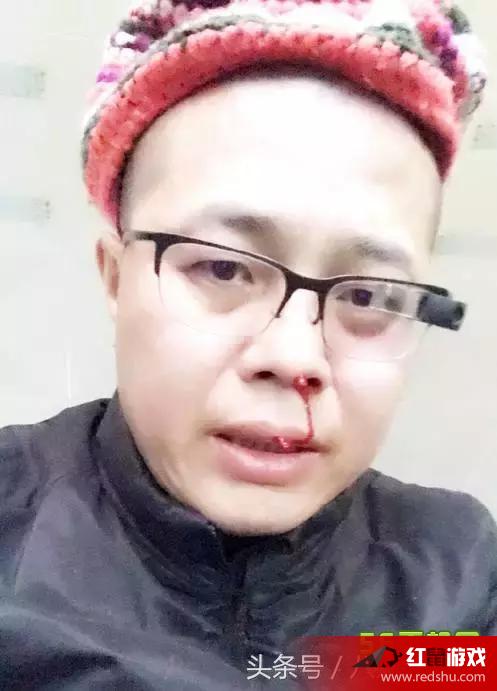 斗鱼tv首富被揍视频_ 鲜血直流疑似炒作